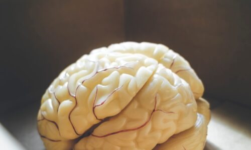 MUZİP BEYİN ATÖLYE ÇALIŞMASI