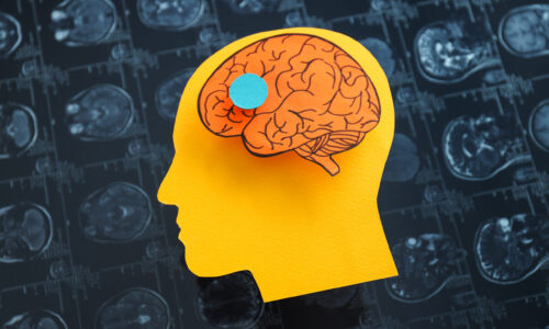 NÖROPLASTİSİTE: BEYNİN DEĞİŞİM VE GELİŞİM SIRRI